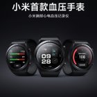 Xiaomi spolu so sériou 14 uvedie smart hodinky s meraním tlaku